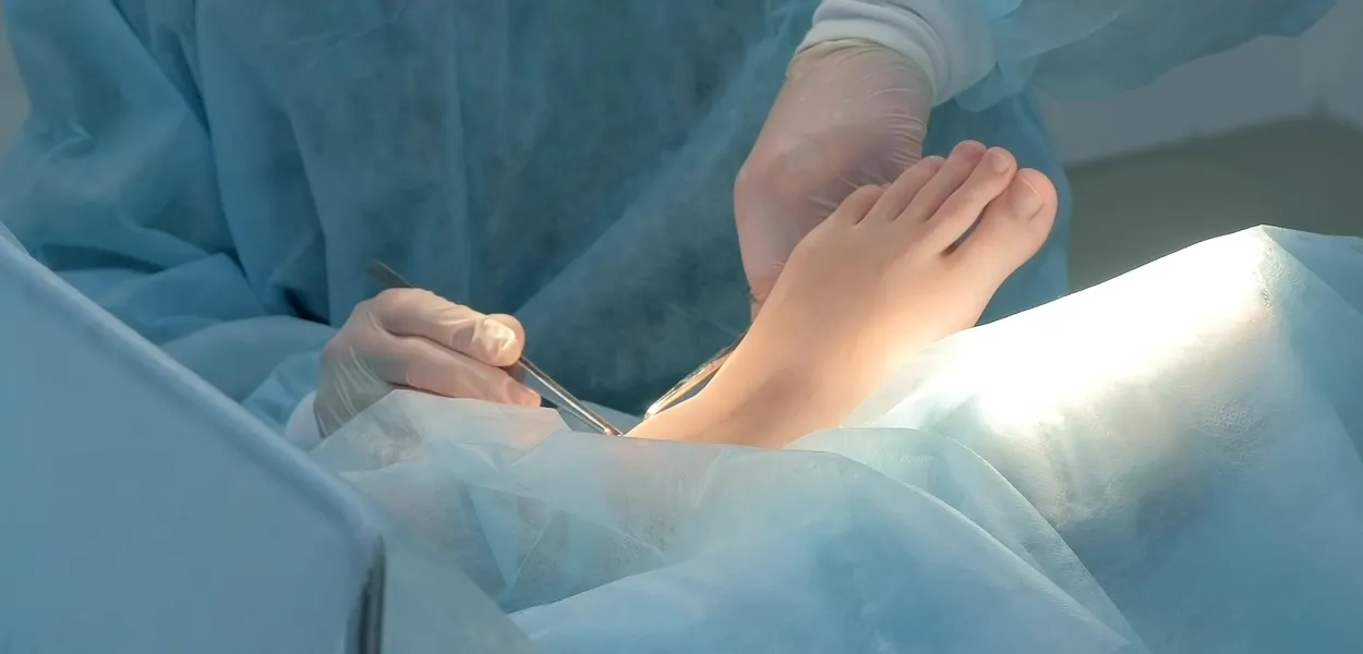 Minimally Invasive Surgery Michfoot Surgeons